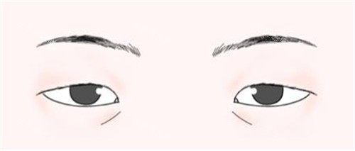 三角眼