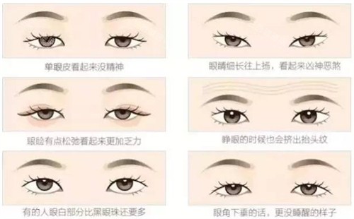 不同可以进行双眼皮的眼睛