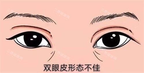 上海徐晓斐双眼皮修复在伯思立坐诊，预约方式|技术特点及口碑评价奉上
