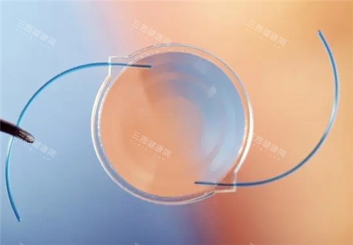 湖南2025年白内障手术怎么收费？查询超声乳化、晶体植入等手术术式费用~