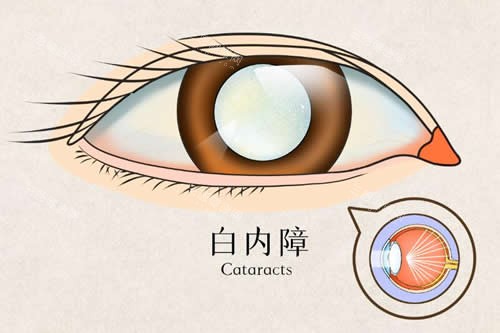 合肥眼科医院哪家好？超全测评合肥维视/慧视/普瑞眼科，技术口碑+服务对比！
