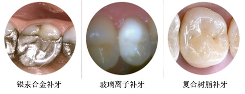嘉定中心医院口腔科2025价格表：洁牙补牙/烤瓷牙全瓷牙/种植牙/牙齿矫正透明收费，省钱攻略大公开