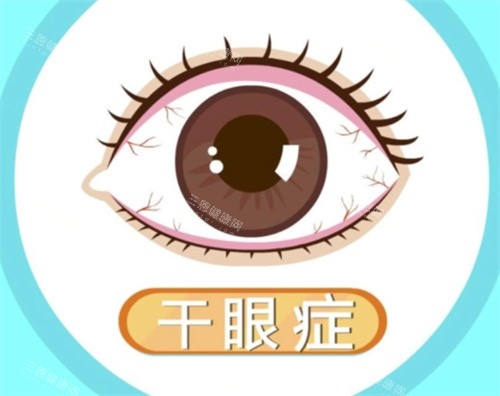干眼症照片