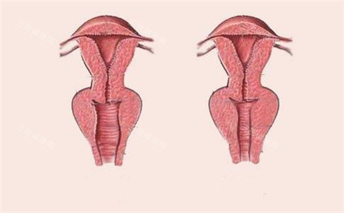 武汉极美伽女性阴道松弛和紧致对比