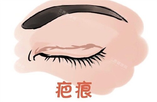 韩勋医生预约面诊全攻略！修复眼睛要6万？成功概率有多高？真实反馈来了！