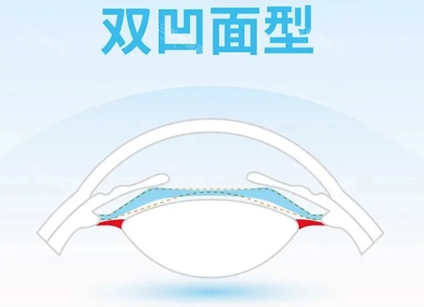 龙晶pr人工晶体双凹面设计