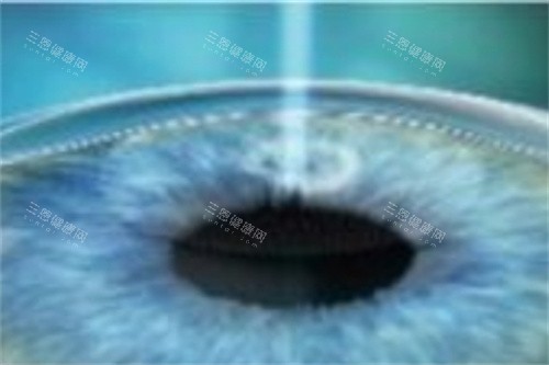 郑州做近视眼手术医院排名，被网友列为前三的眼科医院是这几家呢！
