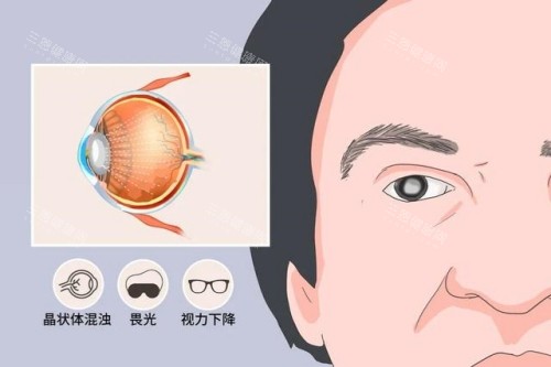 全新上饶爱尔眼科医生名单一览表：鲍晖|陈胜|蒋道源|杨忠望|吴定勇医生擅长项目揭晓