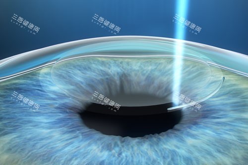 温州医科大学附属第一医院眼科预约挂号，电话、微信、在线预约挂号预约流程整理
