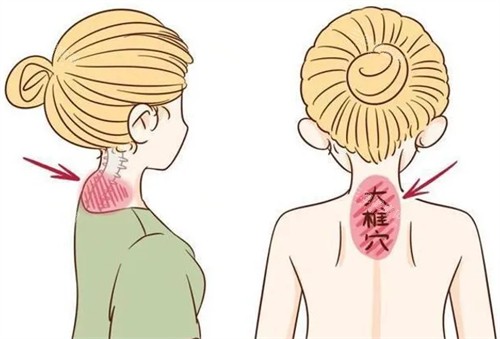 千万别切除富贵包真相揭秘:医生不建议切除富贵包的原因有很多,切除富贵包有后悔的吗?
