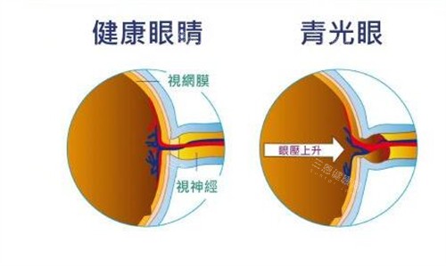 新疆474眼科医院预约挂号，乌鲁木齐474空军医院眼科挂号流程