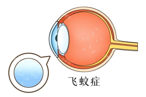 飞蚊症动漫素材