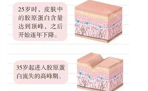 英伦大提升适合30岁吗？轻熟肌抗初老方案，动态纹改善率91%！