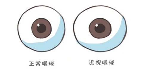 求解：重庆南坪爱尔眼科是正规的吗？结合评价与实际一探究竟