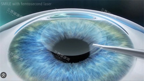 兰州普瑞眼视光医院正规吗？资质文件+医师团队+患者口碑三维度验证
