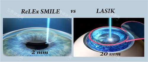 全飞秒和半飞秒图示 全飞秒和半飞秒图示