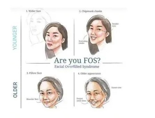 生长因子打了七八年还会继续生长吗？长期跟踪术例告诉你答案！快点击了解！