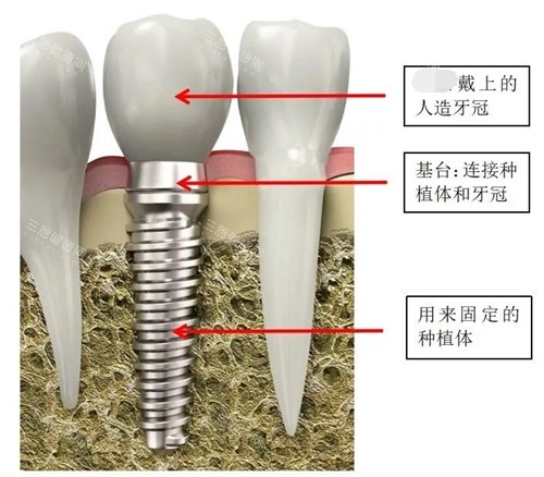 必看！乐山牙科医院收费标准2025版：镶牙|贴面|补牙|拔牙|种植牙|牙齿矫正|儿牙都有！