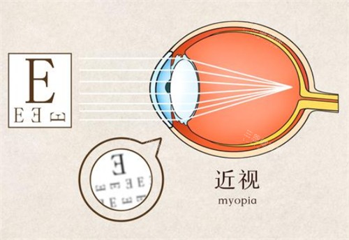 中山大学中山眼科中心2025价格表查询：近视/白内障/OK镜/斜视及青光眼费用参考