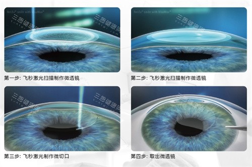 东海县人民医院眼科怎么预约挂号，预约电话号码/网上预约/到院预约流程查看！