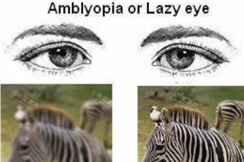 弱视视物对比图