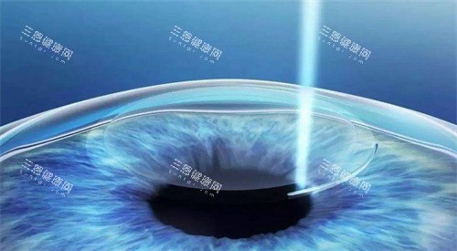哈医大一院眼科网上预约挂号，哈医大一眼科挂号流程详解