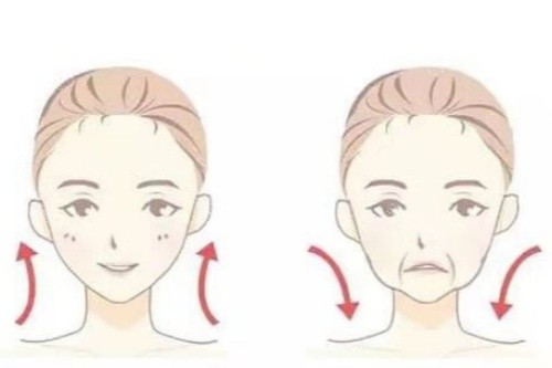 面部提升卡通对比图