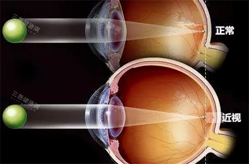 成都军区总医院眼科收费价格表查看，全飞秒近视手术15000起/白内障超声乳化术12000起！