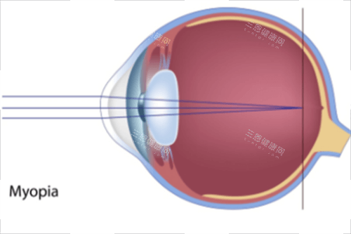 兰州大学第二医院眼科做飞秒怎么样？技术成熟+设备不错，术后成效究竟如何？真实患者口碑大揭密！