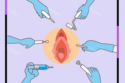 女性私密整形在线询问：医院/医生/价格快速查询，可24小时免费预约手术