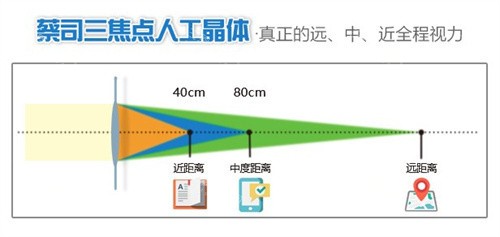 2025年拉萨贝尔西眼科收费价格表揭秘：近视矫正12000+、白内障手术8000+、OK镜6000+