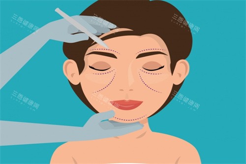 面部提升卡通图