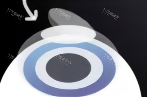 合肥科大眼科地址在哪里？详细交通指南与就诊建议！