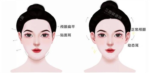 幼态脸适合30岁以上吗？年龄限制与术后保养指南！