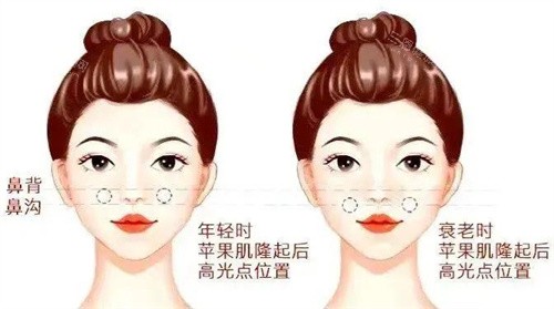 真实测评：4998元幼态脸套餐性价比分析，结果能否达标？