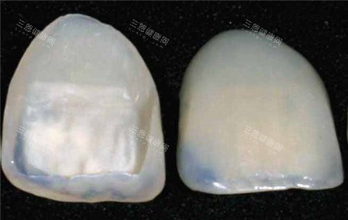 宁德瑞齿口腔牙齿贴面成品