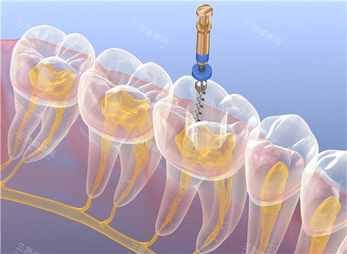 德视佳眼科的价目表：近视眼手术、ICL晶体植入的价格都公布出来了