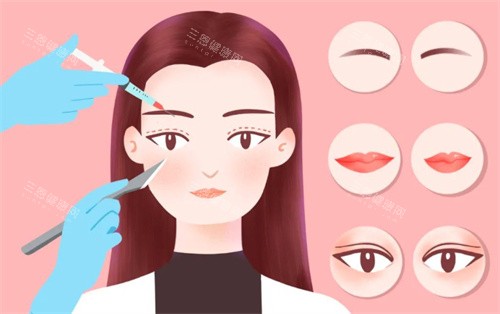 上海张诗若做双眼皮修复绝了！师承杜园园，修复肉条眼宛若天生~