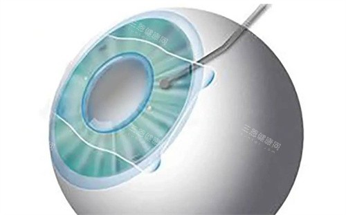 重庆西南医院眼科2025价格表全新公布！手术费用、检查项目全解析，提前了解不踩坑！
