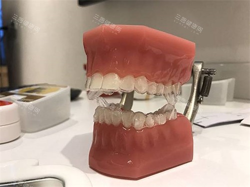 齐齐哈尔牙科医院隐形牙齿矫正牙套模型