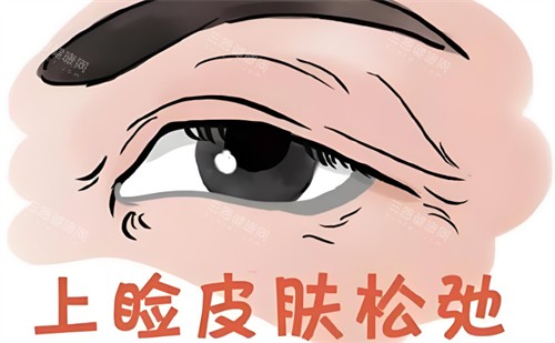 张诗若和徐晓斐谁修复双眼皮好?我亲身面诊两位后,客观分析她们的技术风格与擅长点