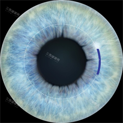 济宁人民医院眼科收费价格表查看，近视矫正9800起/白内障6000起/青光眼2400起！