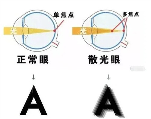 湖北武汉爱尔眼科汉口医院靠谱吗？据说那里的医生经验足，口碑也很不错