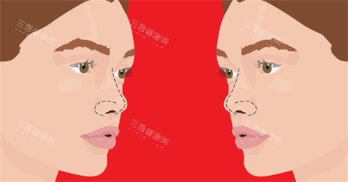 鼻部形态示意图