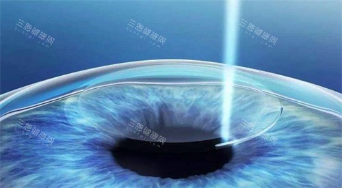 重庆西南眼科医院预约挂号看这里！线上线下全攻略，让你轻松搞定眼科就诊！
