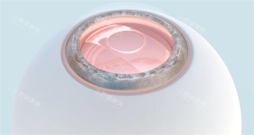 重庆西南眼科医院价格表大揭秘！近视手术1.2W+起、配镜300-5000+、白内障手术5k+