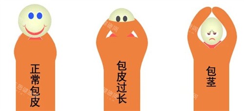 国内男士入珠手术哪家医院正规？这份名单请收好，安心变帅不走弯路！
