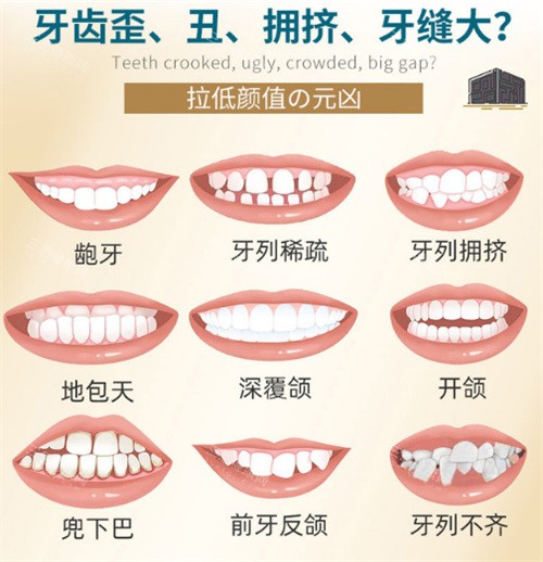 2025贝臣口腔收费全透明！种植牙、矫正、补牙价格一览，省钱又放心！