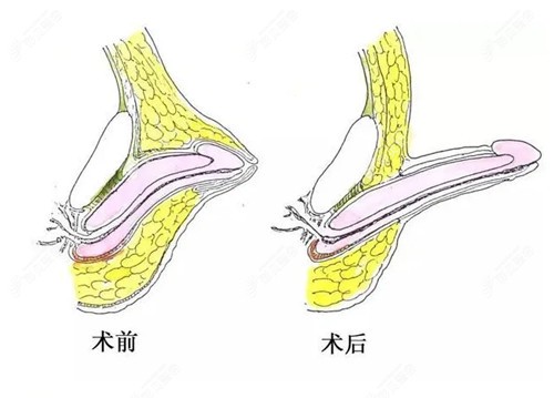 杭州阿波罗医院正规吗？正规又靠谱，看男科非常好，收费也合理