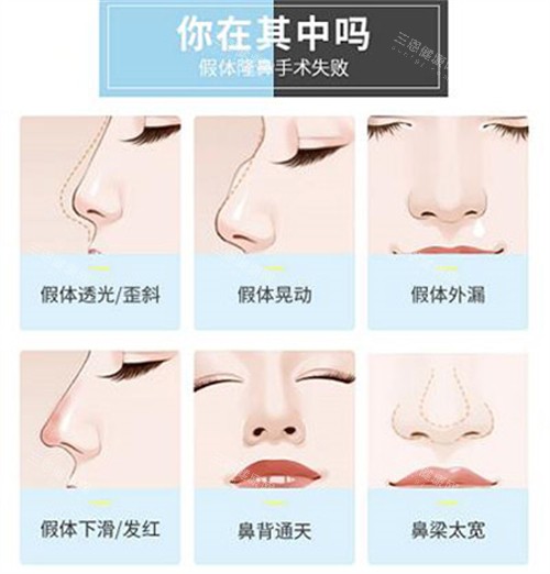 潍坊华美创和整形医院怎么样？资质正规、特色项目、收费标准、口碑评价双手奉上